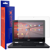Acer Chromebook Spin 11 MatteSkin Screen Protector (2018, Model CP311-1H/CP311-1HN)