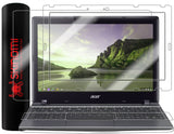 Acer Chromebook 11.6" Skin Protector